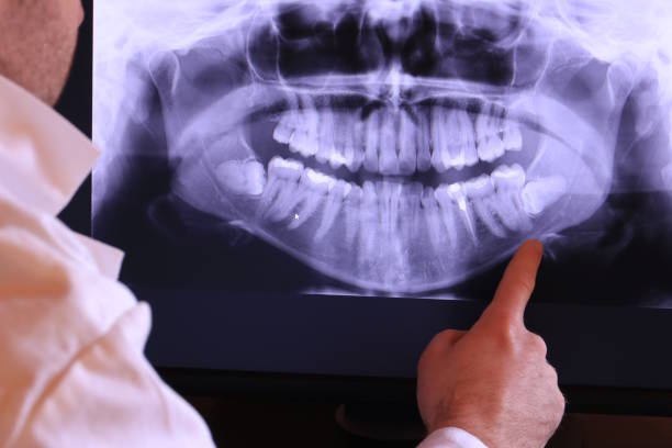 Best Pediatric Emergency Dentist in Audubon, PA