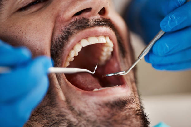 Best Emergency Dental Care for Abscessed Tooth in Audubon, PA