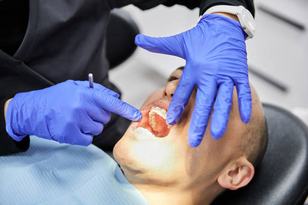 Best Emergency Dentist for Lost Fillings or Crowns in Audubon, PA